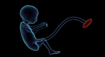 Clampaggio del cordone ombelicale: sai come si è evoluto nel corso degli anni?